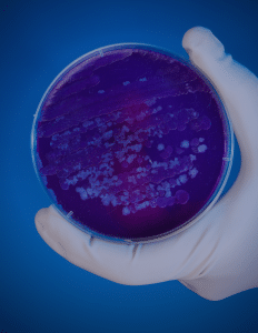 Photo of a gloved hand holding a petri dish